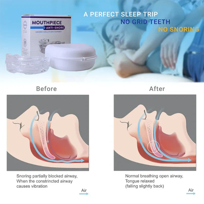 Griqos™ Anti Snoring Mouthpiece - Say goodbye to sleepless nights
