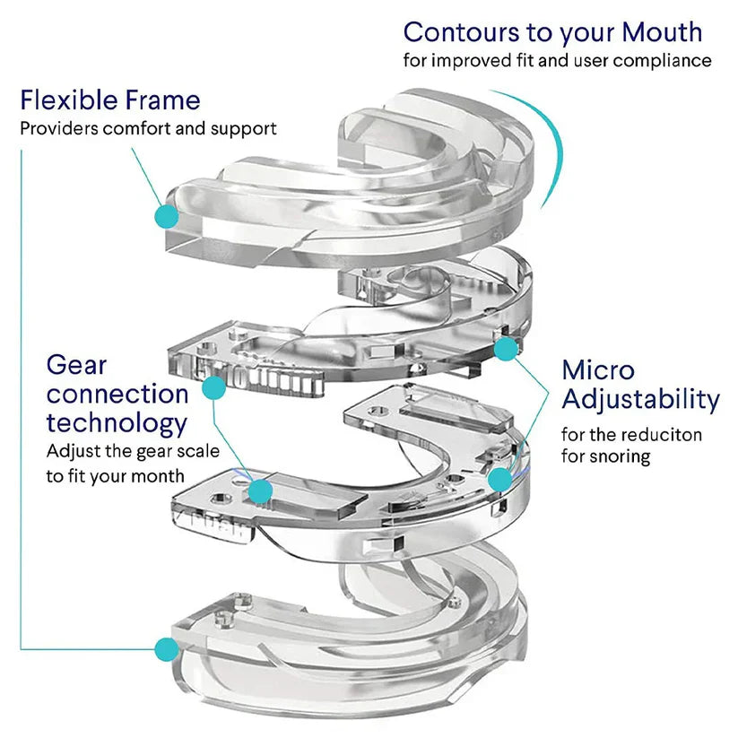 Griqos™ Anti Snoring Mouthpiece - Say goodbye to sleepless nights