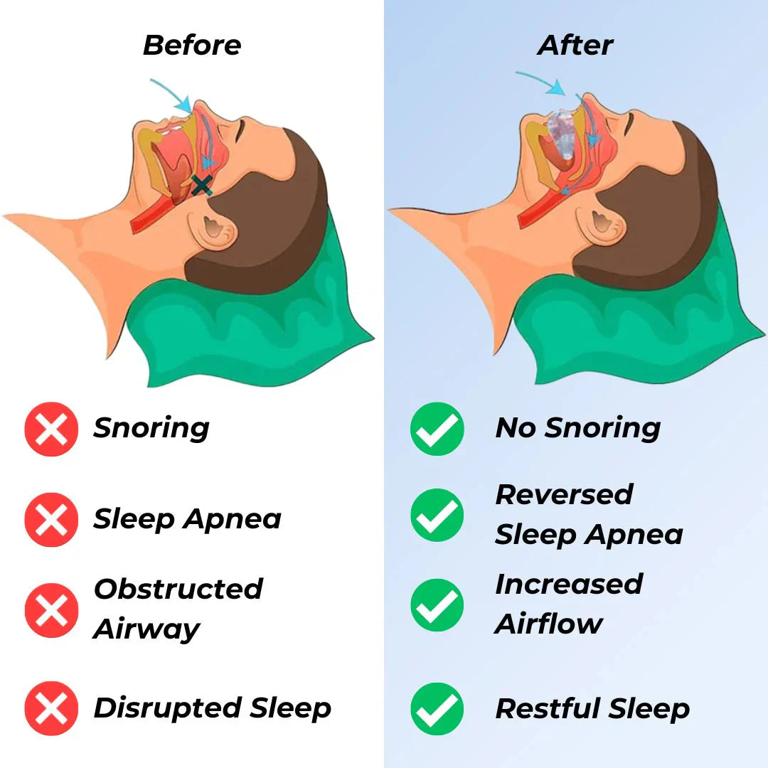 Griqos™ Anti Snoring Mouthpiece - Say goodbye to sleepless nights
